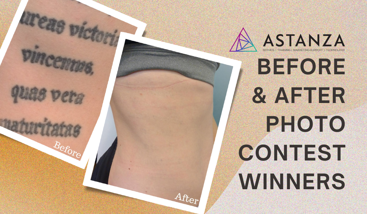 Astanza Laser Aesthetic Before and After Photos Contest