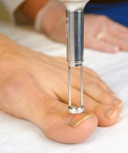 toenail treatment web.jpg