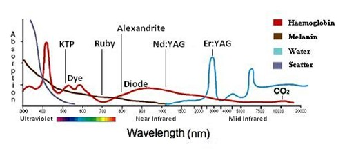 Comparing Erbium YAG to CO2 lasers