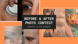 Copy of Click to Enter Astanzas Before and After Photo Contest