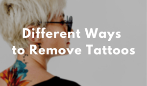 Different Ways to Remove Tattoos 