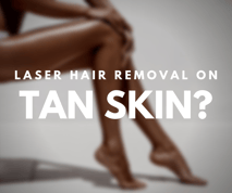 Does Laser Hair Removal work on tan skin_ 