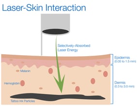 Laser-Skin-Interaction