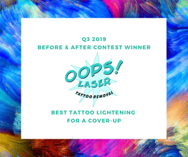 Q3 2019 Before and After winner - Best tattoo lightening for a cover-up