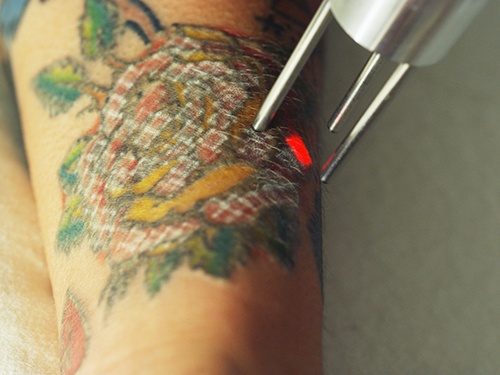 The 2022 StateByState Definitive Guide to Tattoo Laws in the United States