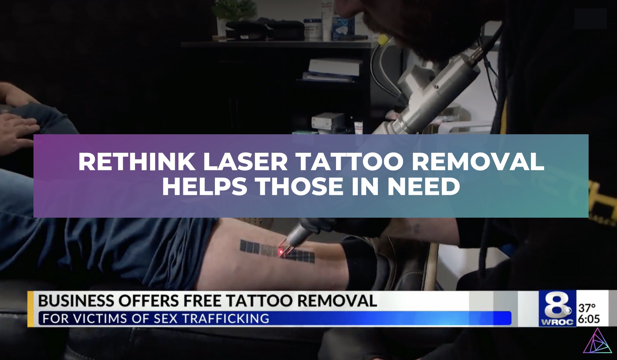 Laser Tattoo Removal Specialist  Rochester MI Rochester Laser Center  Laser  Medical Spa