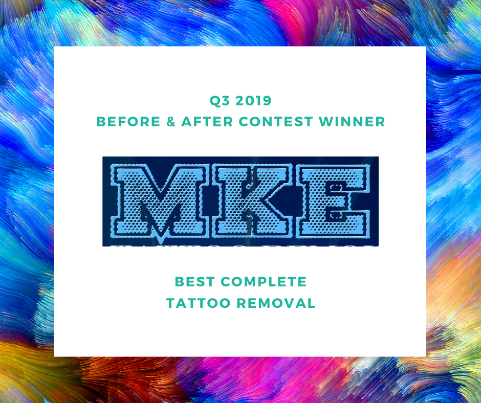 Removery Tattoo Removal  Fading  Milwaukee WI 53207  8664882207   ShowMeLocalcom