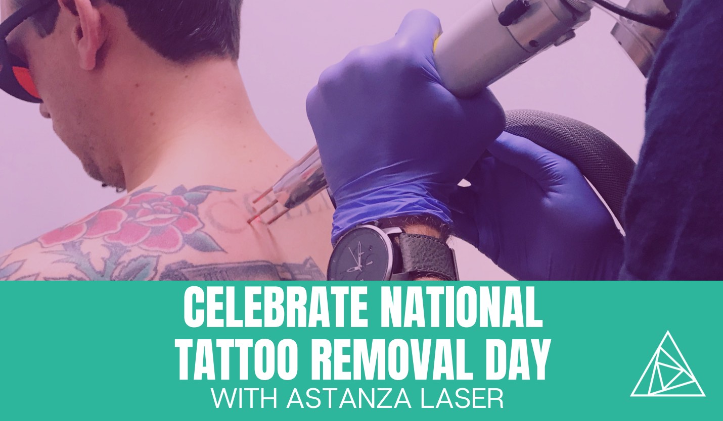 Celebrate National Tattoo Removal Day With Astanza Laser